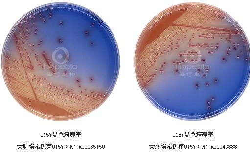 O157顯色培養(yǎng)基